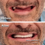 خدمات دندانپزشکی. ایمپلنت جراحی لثه دکتر قادری
