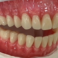 دندانسازی جُردن