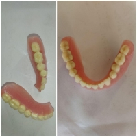 تعمیر وساخت دندان مصنوعی