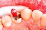 خدمات دندانپزشکی حرفه ای