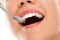 زیبایی لبخند با بهترین متخصص دندانپزشکی در شمال تهران