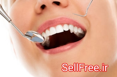 زیبایی لبخند با بهترین متخصص دندانپزشکی در شمال تهران