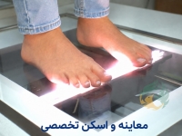 اسکن کف پا اکباتان