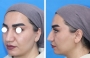 فتوگرافی پزشکی زیبانگر