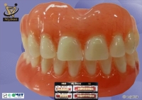 دندانسازی مجابی