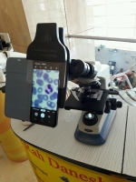 عکسبرداری میکروسکوپی با دورببن تلفن همراه (موبایل آداپتور