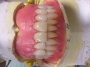 لابراتوار دندانسازی قالبگیری ساخت تعمیر ترمیم دندان مصنوعی