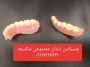لابراتوار دندانسازی قالبگیری ساخت تعمیر ترمیم دندان مصنوعی